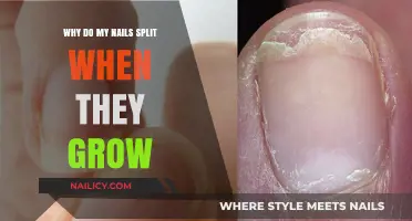 Nail Splitting: Causes and Prevention Methods