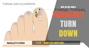Why Do My Nails Suddenly Turn Down? Causes and Solutions