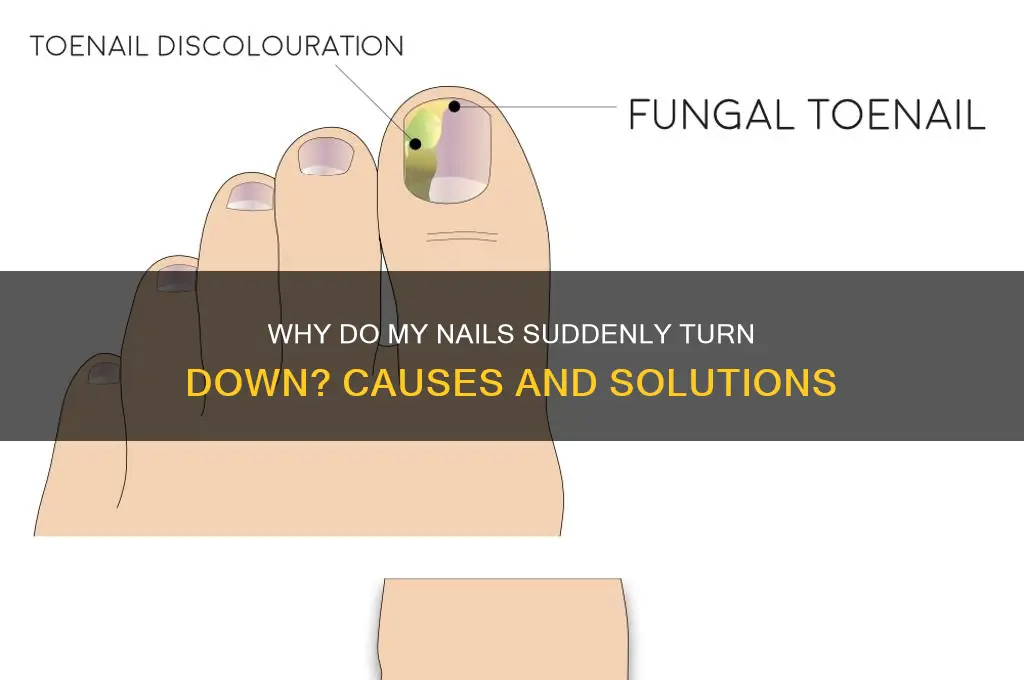 why do my nails suddenly turn down
