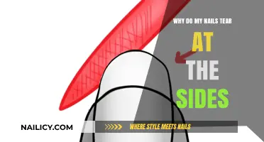 Why Do My Nails Tear at the Sides? Causes and Solutions
