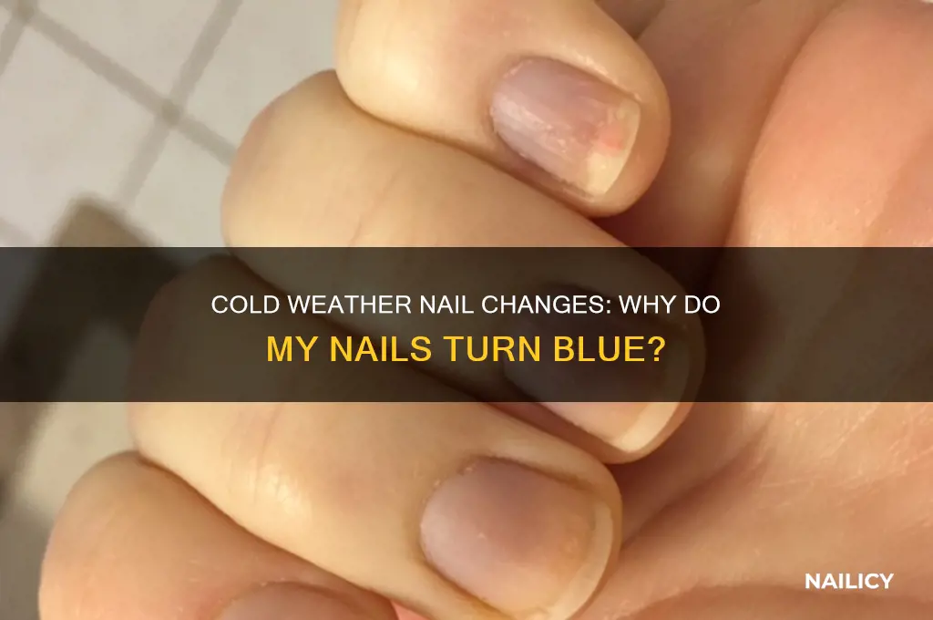 why do my nails turn blue when cold