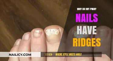 Why Do My Pinky Nails Have Ridges? Causes and Solutions