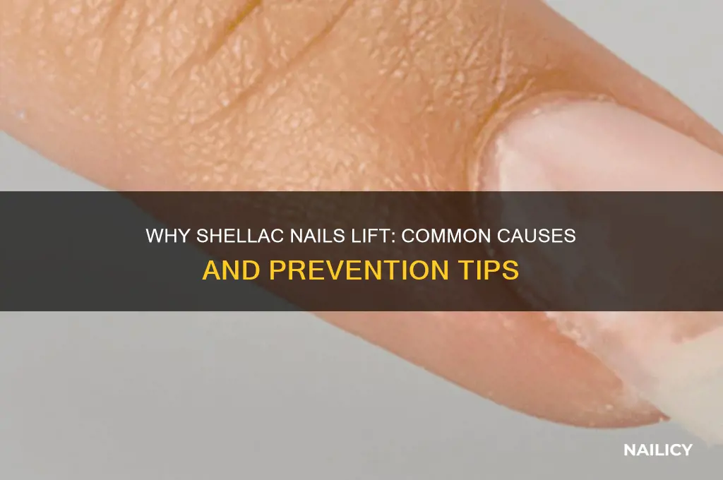 why do my shellac nails keep lifting