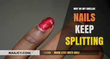 Why Shellac Nails Split: Causes and Prevention Tips for Strong Nails