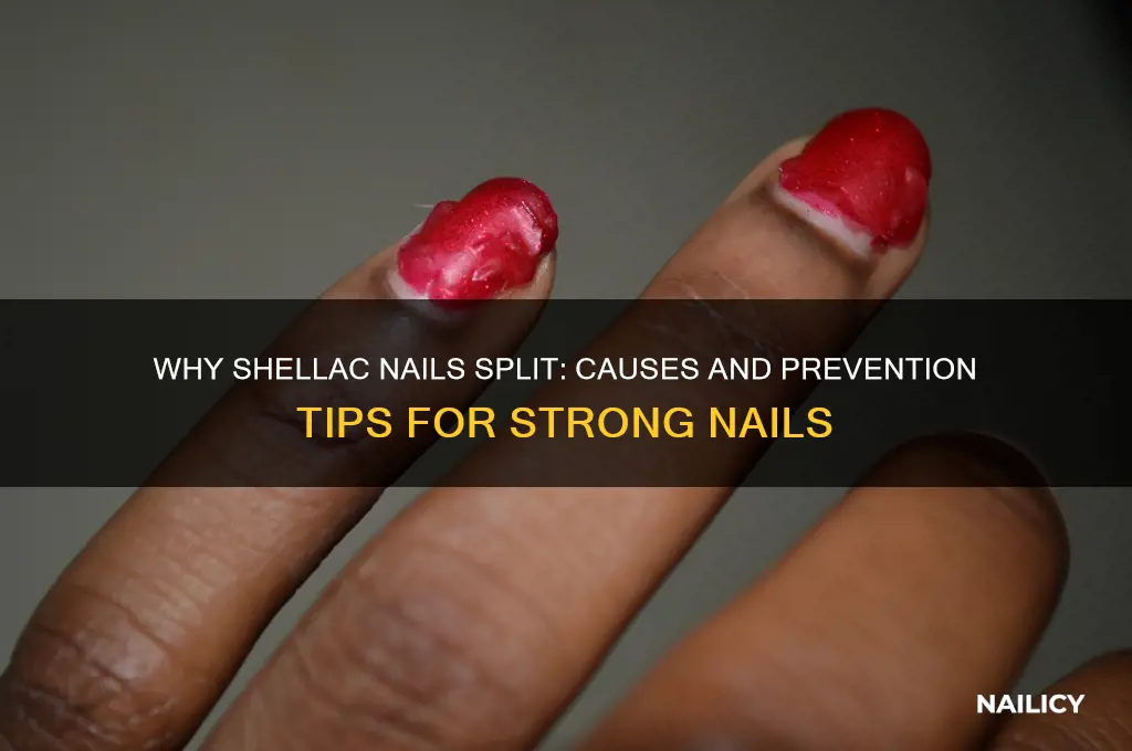 why do my shellac nails keep splitting