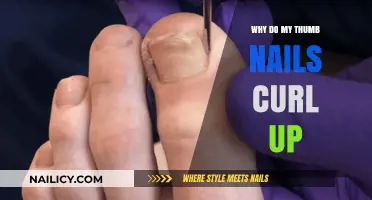 Why Do My Thumb Nails Curl Up? Causes and Solutions