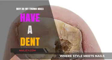 Thumb Nail Dents Explained: Causes and Solutions for Healthy Nails