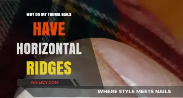 Why Horizontal Ridges Appear on Your Thumbnails: Causes Explained