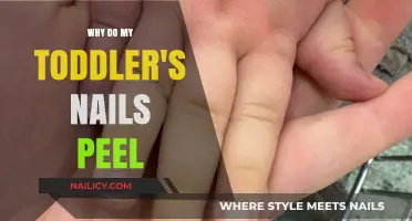 Why Toddler's Nails Peel: Causes, Prevention, and Gentle Care Tips