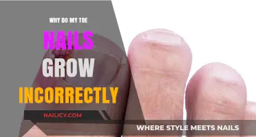 Toe Nail Growth: Why Do They Grow Wrong?
