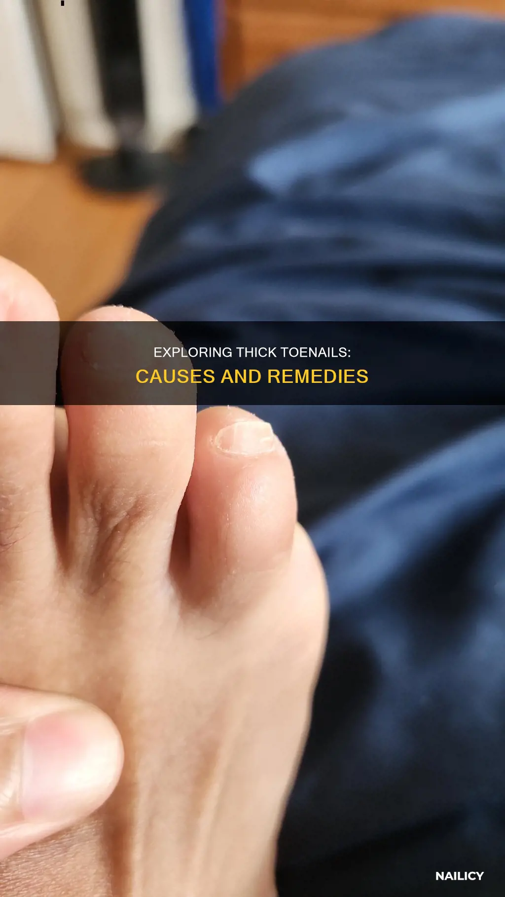 why do my toe nails grow so thick