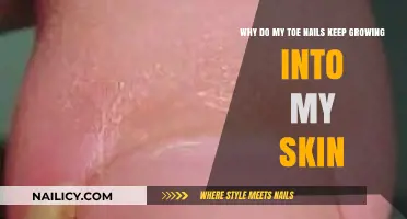 Toe Nail Troubles: Ingrown Causes and Solutions