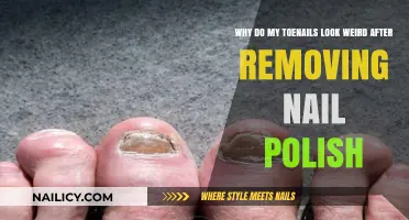 Toenail Trauma: Post-Polish Woes and Remedies