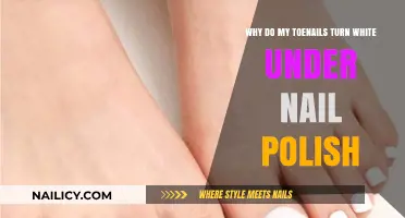 Why Toenails Turn White Under Nail Polish: Causes and Solutions