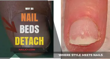 Why Nail Beds Detach: Causes, Symptoms, and Treatment Options Explained