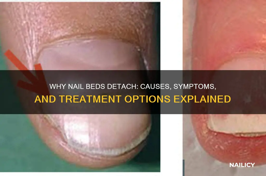 why do nail beds detach
