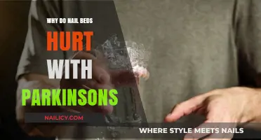 Understanding Nail Bed Pain in Parkinson's Disease: Causes and Relief