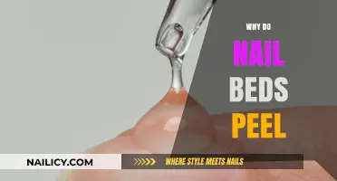Why Do Nail Beds Peel? Causes, Prevention, and Treatment Tips