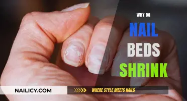 Why Do Nail Beds Shrink? Causes and Solutions Explained