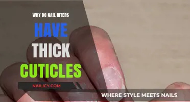 Nail Biting Habits: Why Thick Cuticles Develop and How to Stop