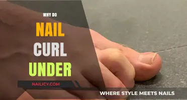Why Do Toenails Curl Under? Causes, Prevention, and Treatment Explained