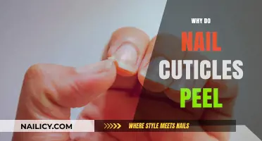Why Do Nail Cuticles Peel? Causes, Prevention, and Care Tips
