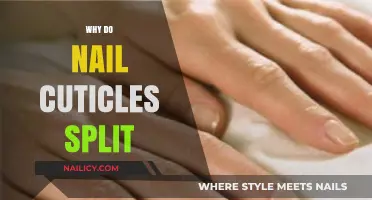 Why Do Nail Cuticles Split? Causes, Prevention, and Care Tips