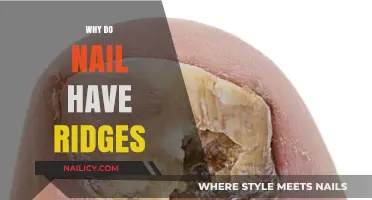 Why Do Nails Have Ridges? Causes and Solutions Explained