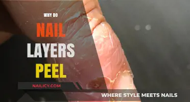Why Do Nail Layers Peel? Causes and Solutions Explained