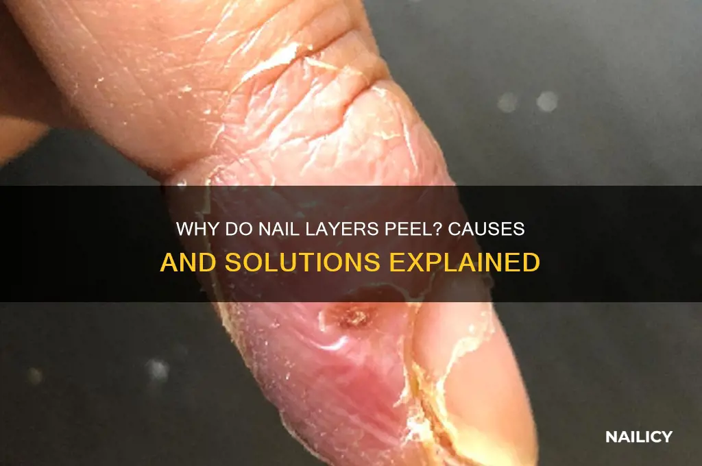 why do nail layers peel