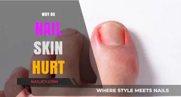 Why Does Nail Skin Hurt? Causes and Remedies Explained
