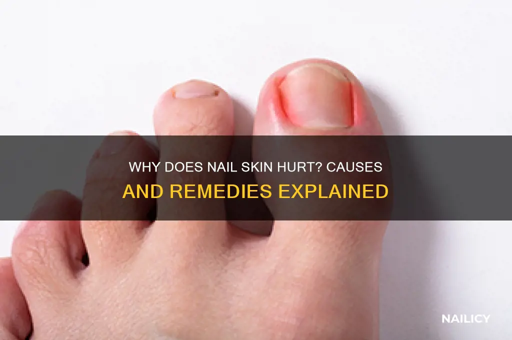 why do nail skin hurt