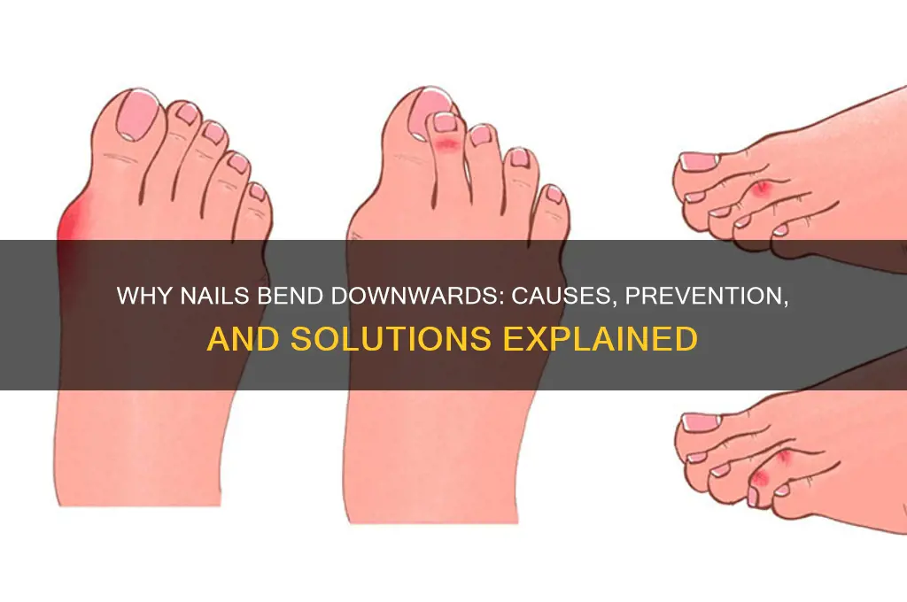 why do nails bend downwards