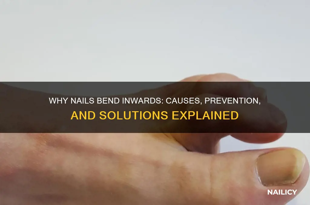 why do nails bend inwards