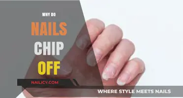 Why Do Nails Chip Off? Causes and Prevention Tips