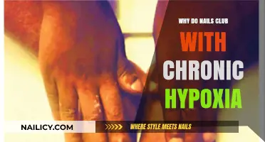 Understanding Clubbed Nails: Chronic Hypoxia's Impact on Nail Health