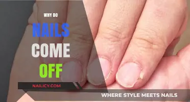 Why Nails Detach: Causes, Prevention, and Treatment Explained