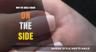 Why Do Nails Crack on the Side? Causes and Prevention Tips