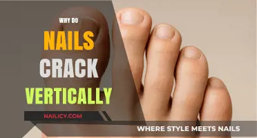 Why Do Nails Crack Vertically? Causes and Prevention Tips
