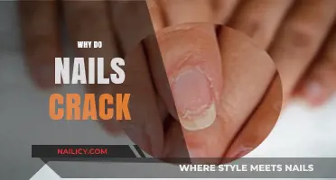 Why Do Nails Crack? Causes and Prevention Tips Revealed