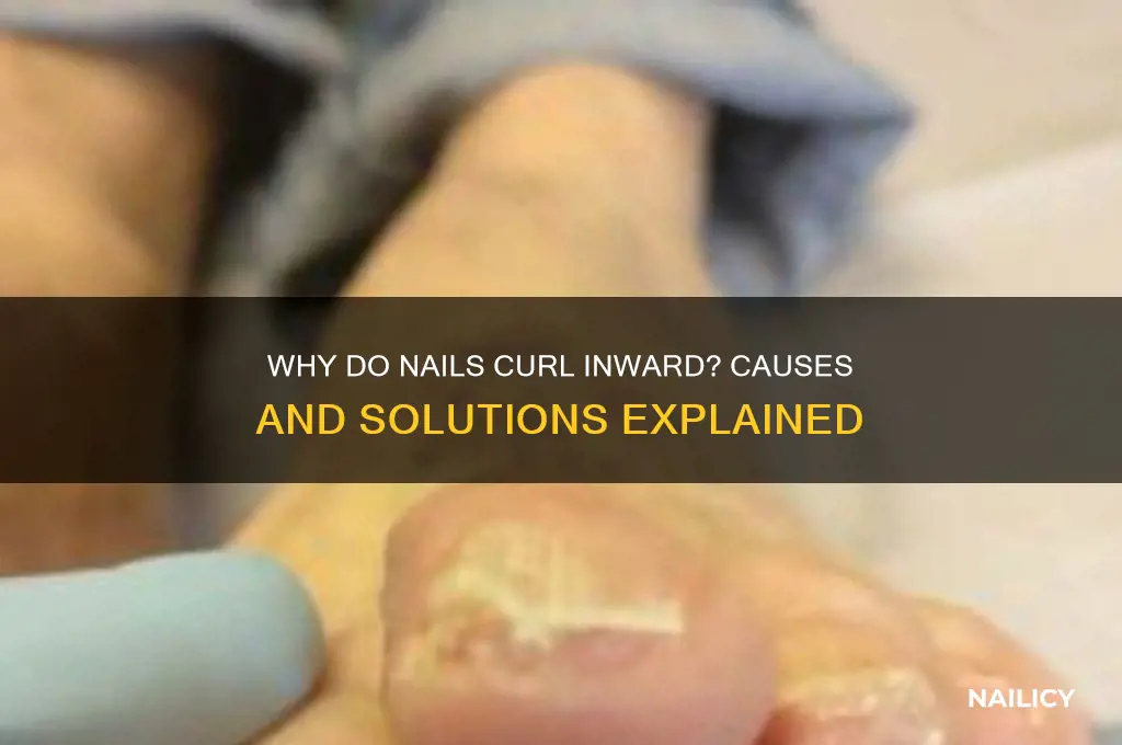 why do nails curl inward