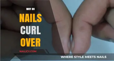 Why Nails Curl Over: Causes, Prevention, and Effective Solutions