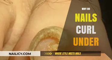 Why Nails Curl Under: Causes, Prevention, and Effective Solutions