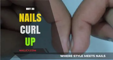 Why Do Nails Curl Up? Understanding Causes and Solutions