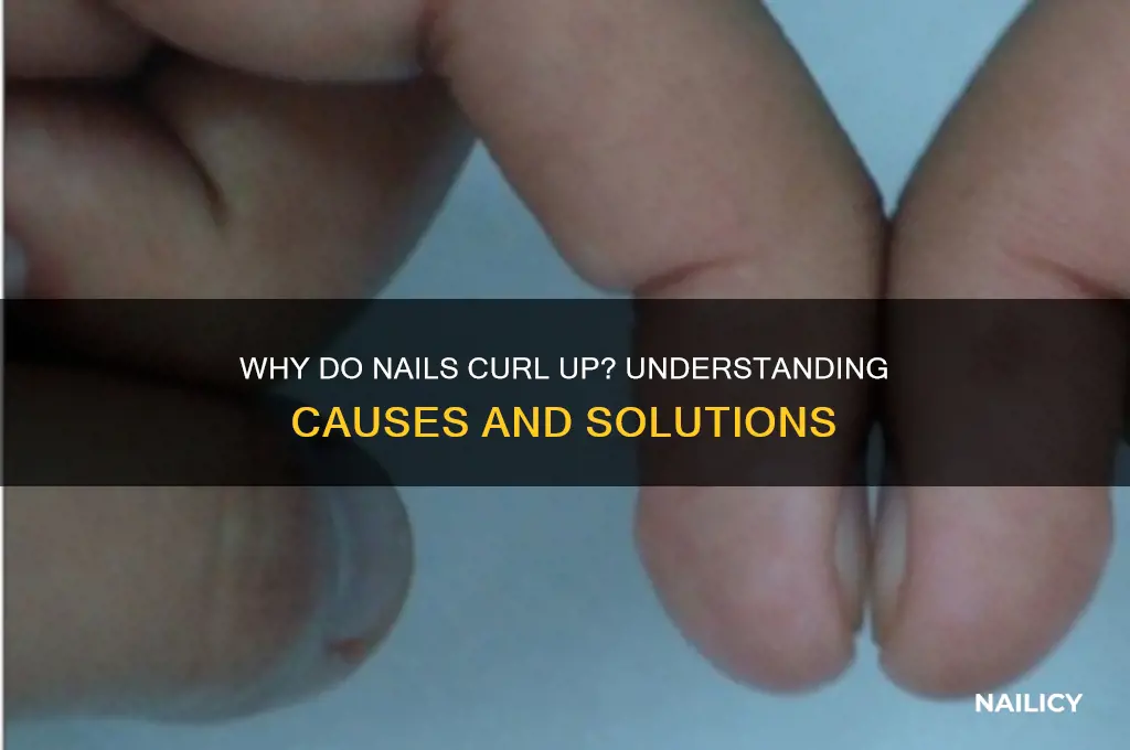 why do nails curl up