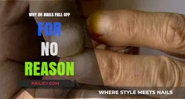 Why Nails Fall Off Unexpectedly: Causes and Solutions Explained