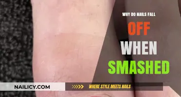 Why Smashed Nails Fall Off: Understanding the Painful Process
