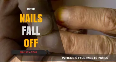Why Nails Fall Off: Causes, Prevention, and Recovery Explained