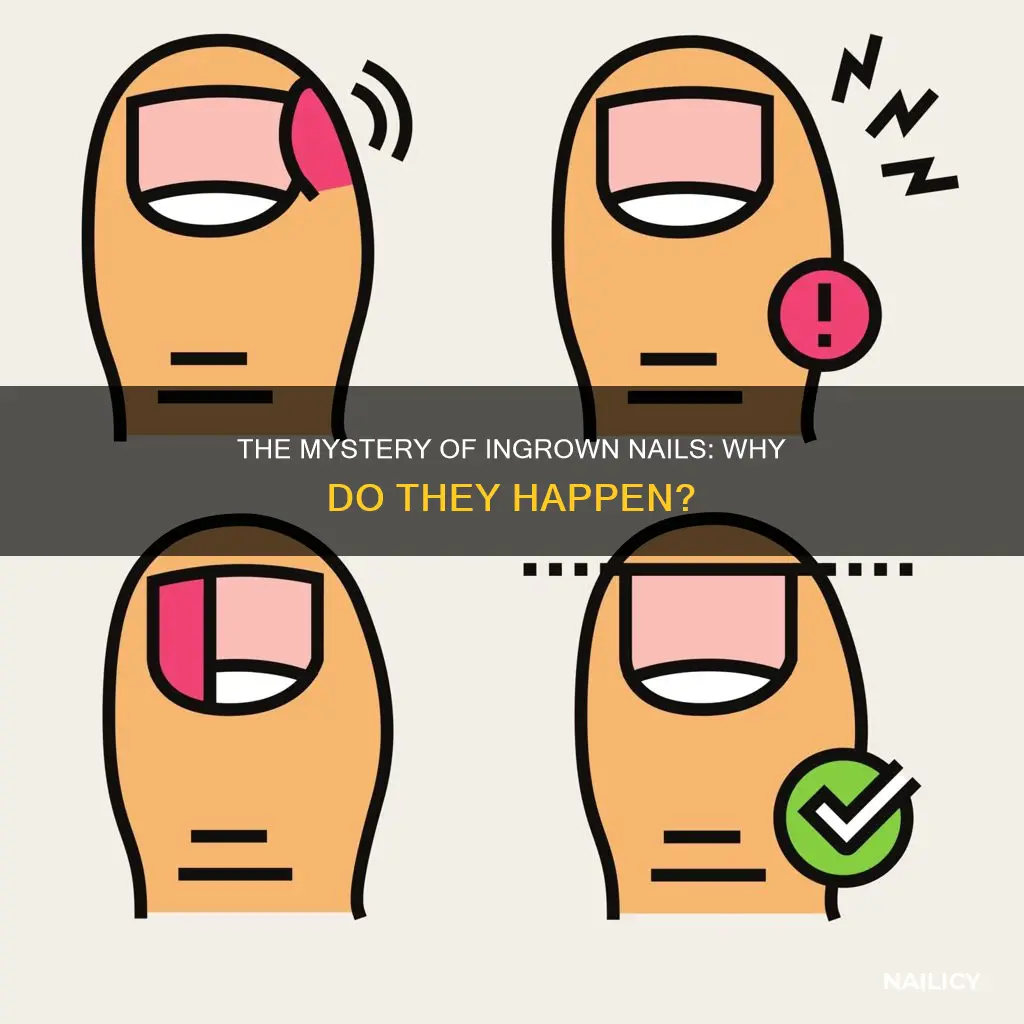 why do nails grow inward