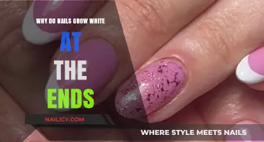 Nail Health: White Ends Explained